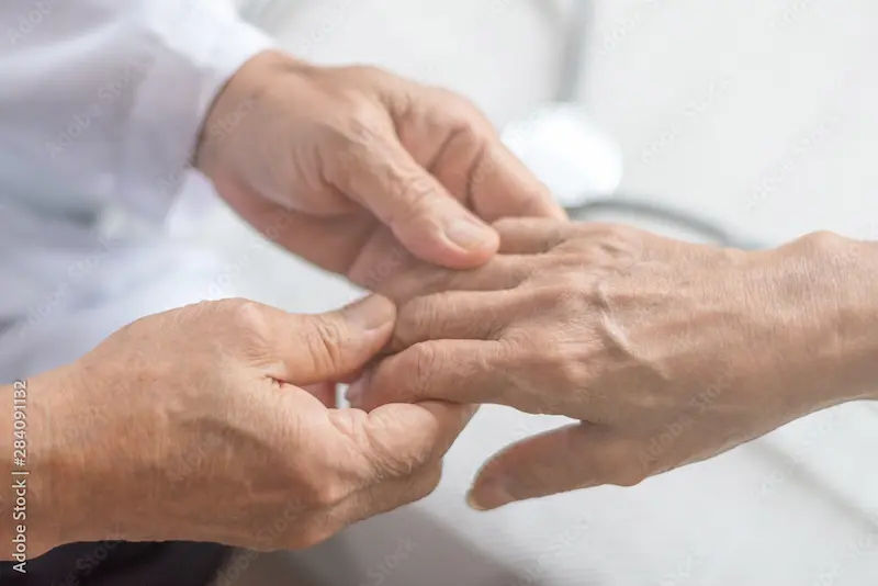 Managing Parkinson's Disease A Guide to Modern Treatment Options